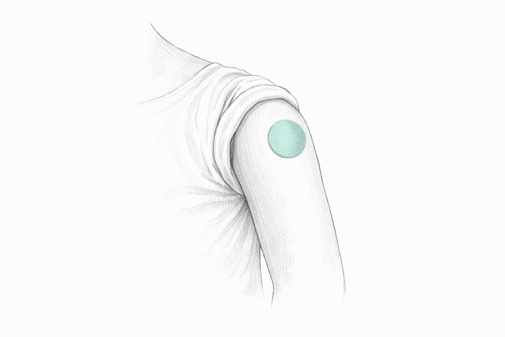 Vaccinationssted børn over 2 år - EMLA plaster sat på venstre overarm under skulder.